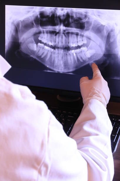 Best Dentist for Tooth Abscess  in Dent, OH