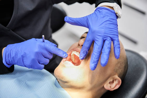Best Knocked-Out Tooth Emergency  in Dent, OH